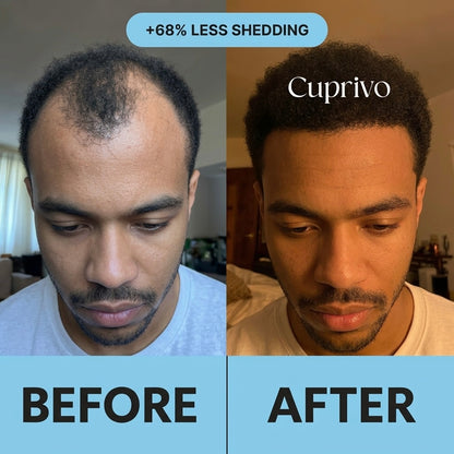 Cuprivo Hair Regrowth System