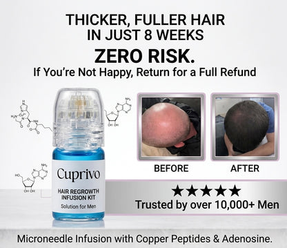 Cuprivo Hair Regrowth System