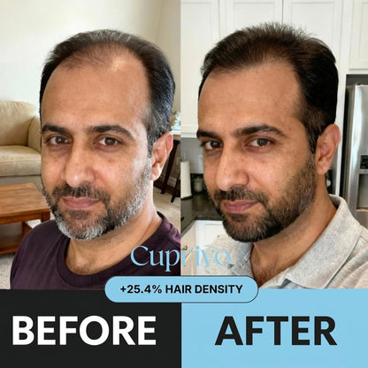 Cuprivo Hair Regrowth System